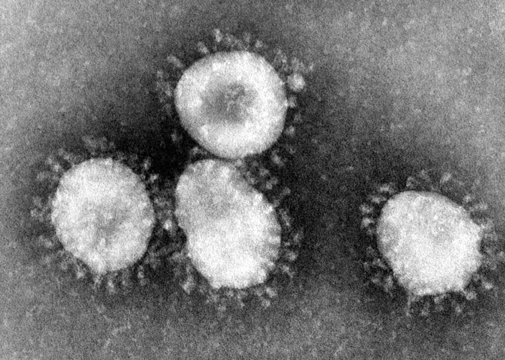Análisis: ¿Qué nos va a pasar con el coronavirus? </br>El SARS-CoV-2 ha venido para quedarse