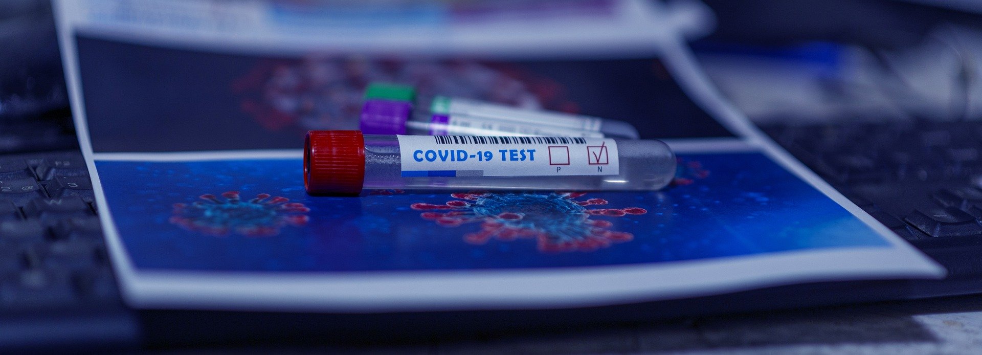 ¿Puedo haber pasado el coronavirus y dar negativo en el test de anticuerpos?