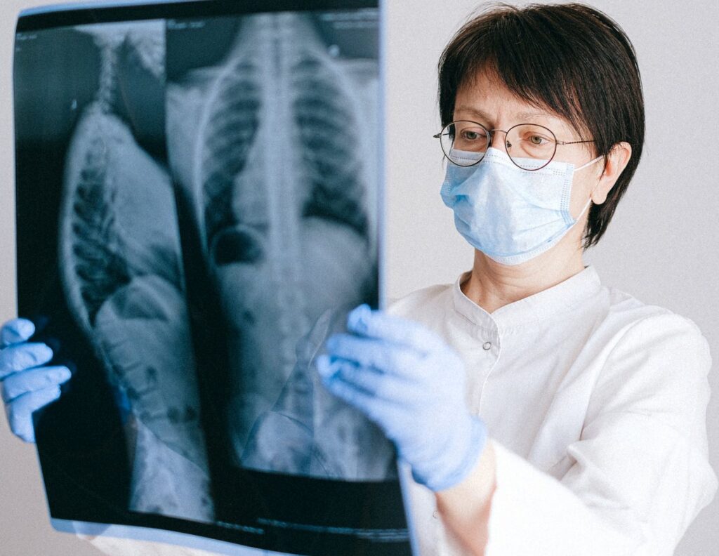 Radiografía al paciente de Covid-19 en España: síntomas al ingreso, complicaciones, pronóstico…