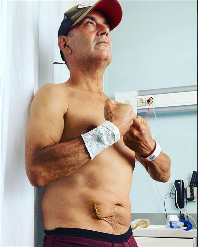 José Corbacho y su trasplante de riñón