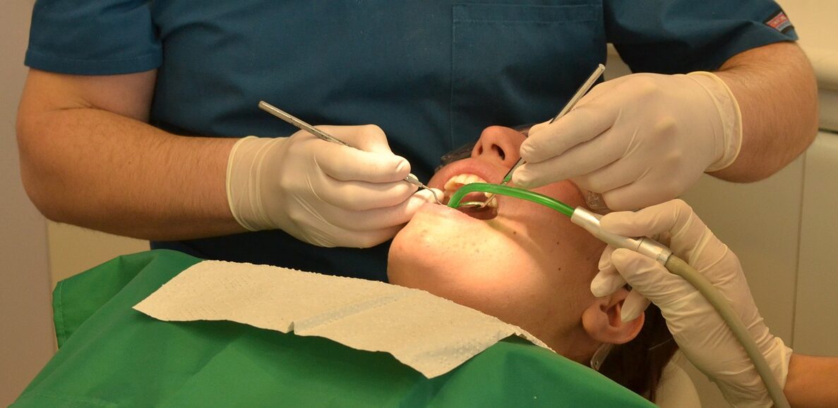 Así es la periodontitis, la enfermedad de las encías que puede agravar los síntomas de coronavirus