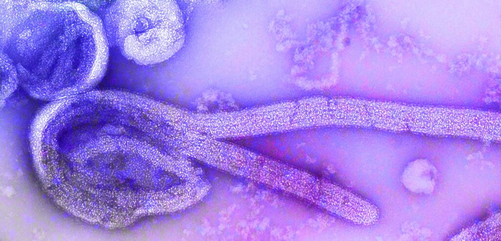 «El futuro que viene» (y 3)</br>Sabemos que 827.000 virus pandémicos podrían dar el salto a humanos en cualquier momento ¿Es evitable?