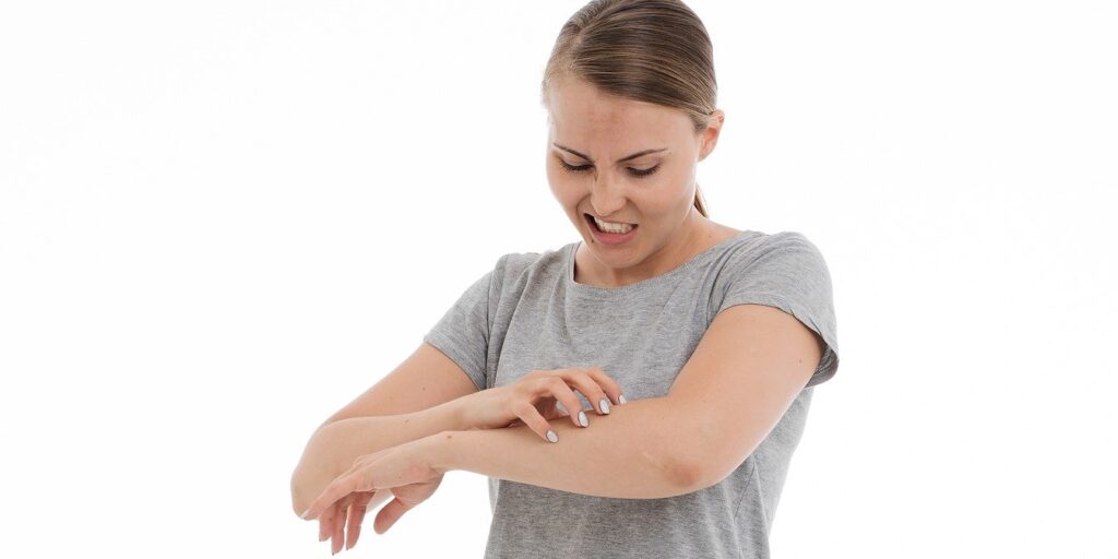 Qué es la dermatitis atópica y cómo evitar el desesperante picor