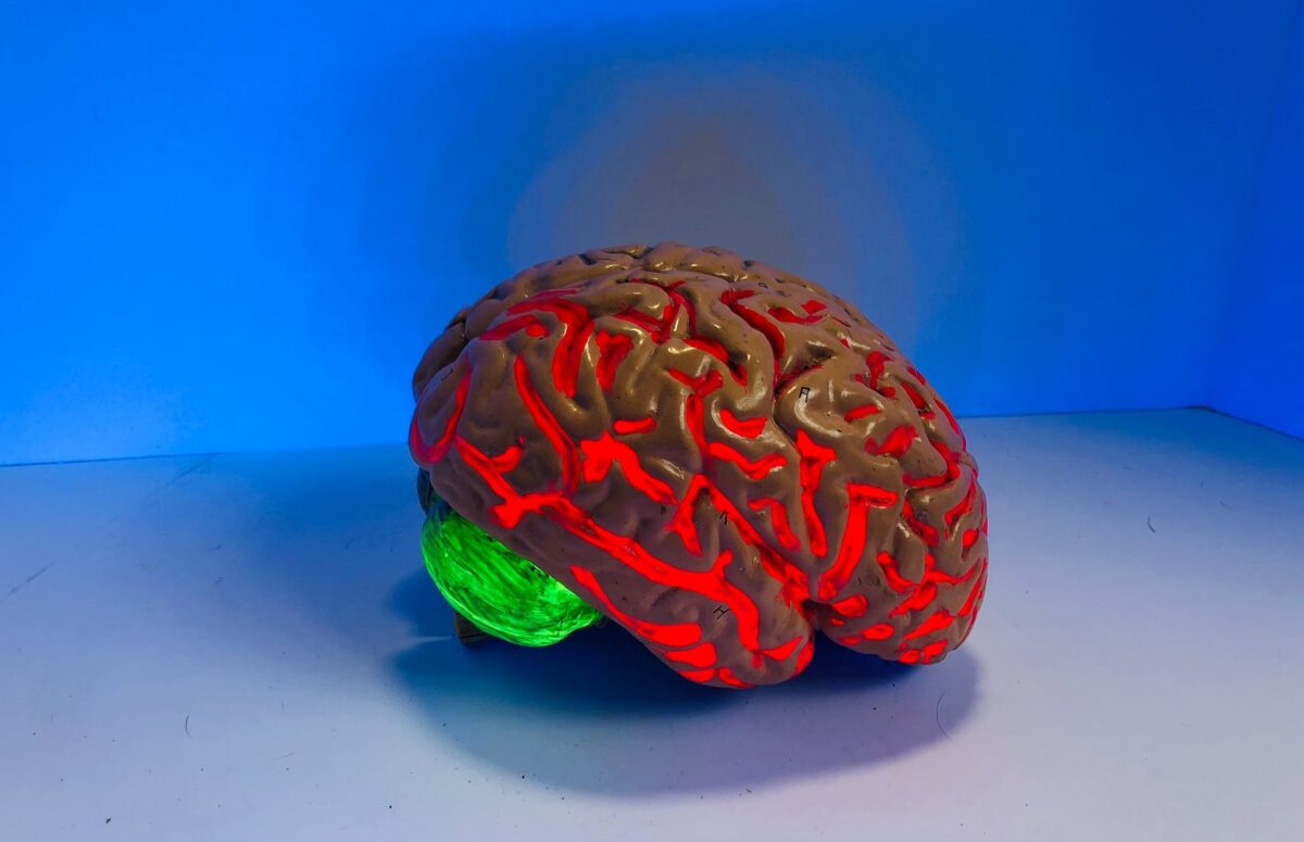 ¿Compensan las células cerebrales los daños causados por un ictus?