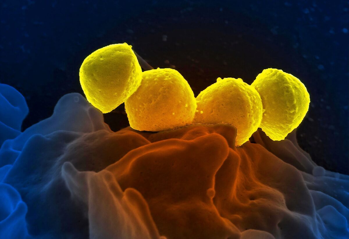 Las células humanas crean su propio «detergente» contra las infecciones