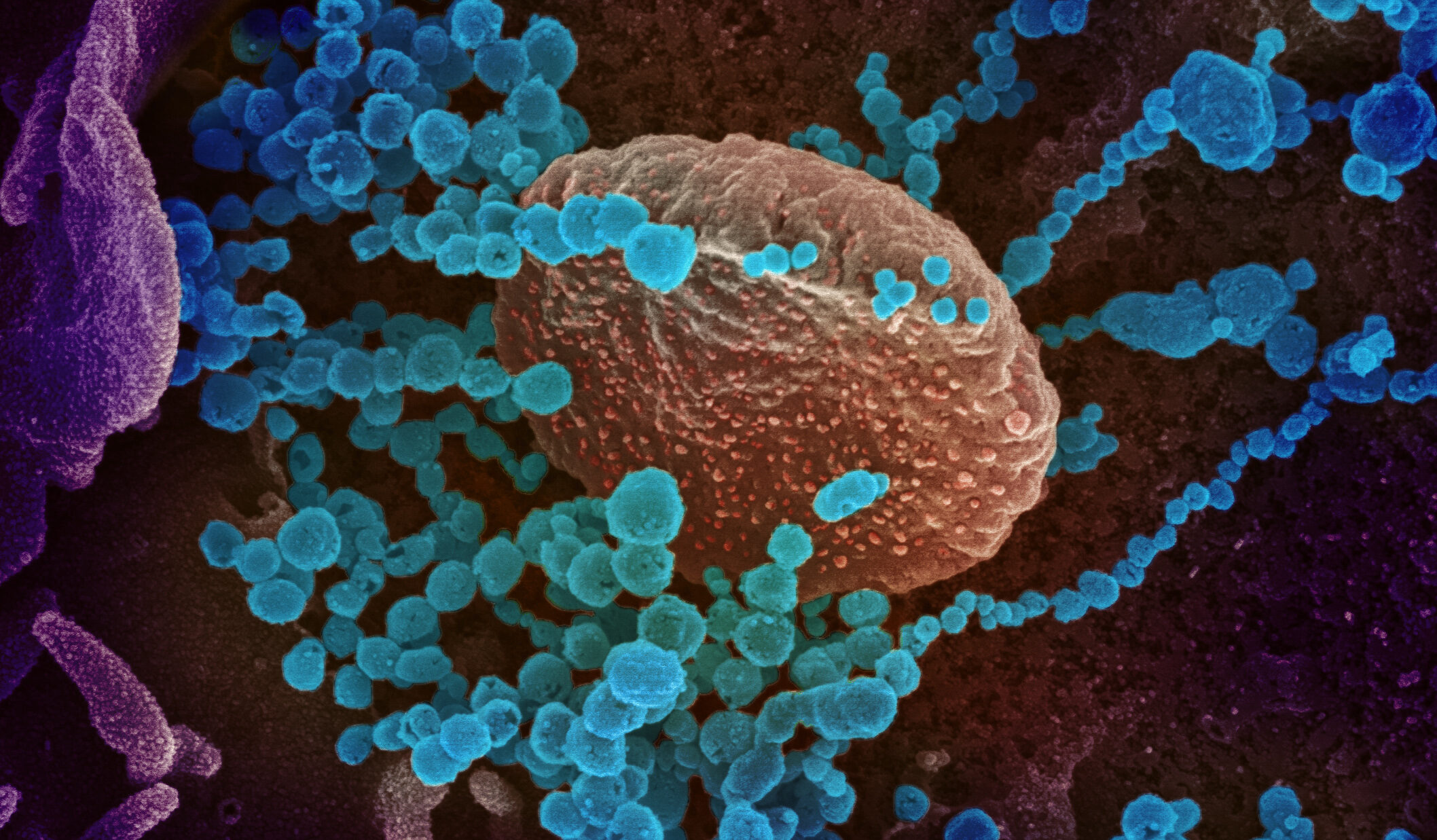 ¿A qué se debe el nuevo repunte de coronavirus que está afectando a Europa?