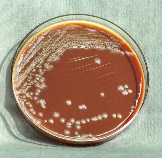 Así crece la bacteria Yersinia pestis en un medio de agar, durante un período de 72 horas, a 25 °C.