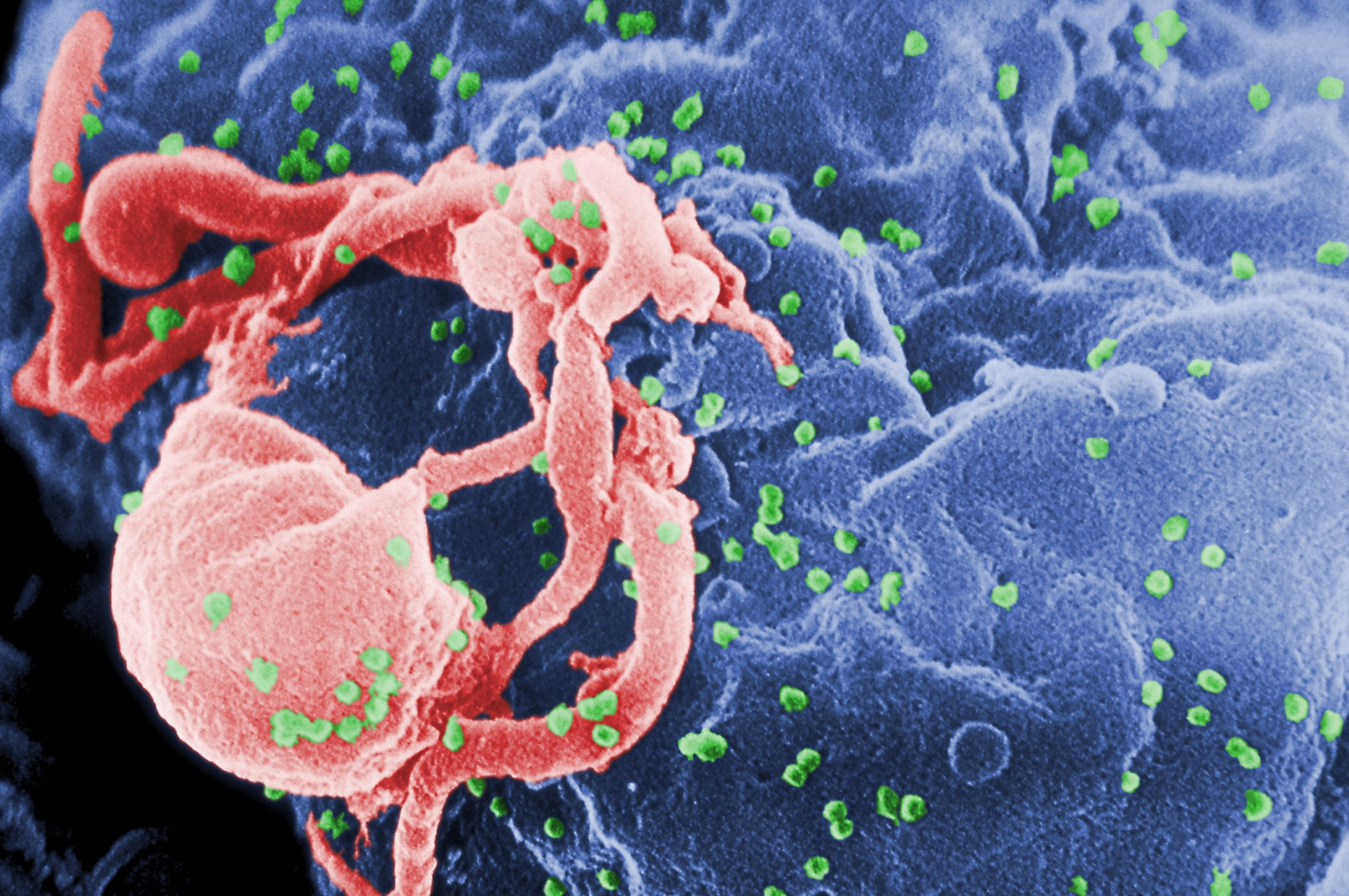 El virus del SIDA es lento en su desarrollo, pero muy eficaz y muy letal